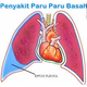Illustration for article titled Apakah Penyakit Paru Paru Basah Berbahaya